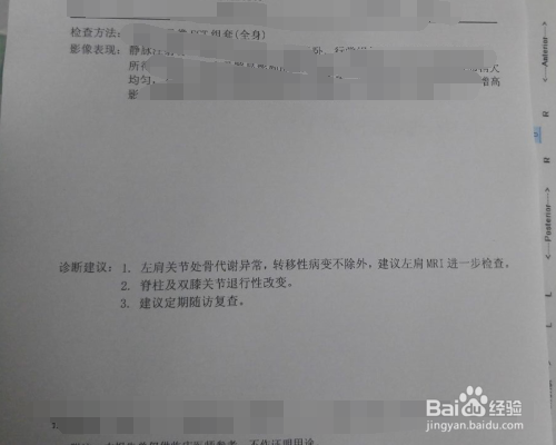 骨扫描报告怎么看