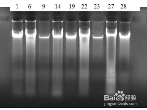 dna电泳条带怎么分析?