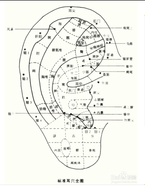 治疗近视用耳穴压豆法是什么体验