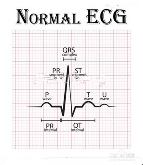 心电图怎么看,心电图讲解,心电图t波改变