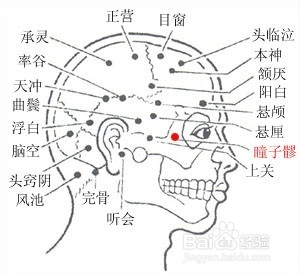 喝酒后头疼怎么办?