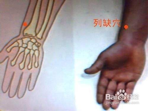 春季养生肝火过旺 防春季9大上火症状