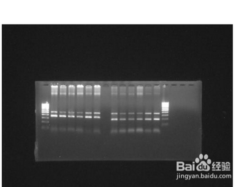 dna电泳条带怎么分析?