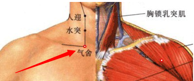 气舍穴位于颈部,当锁骨内侧端的上缘,胸锁乳突肌的胸骨头与锁骨头之间