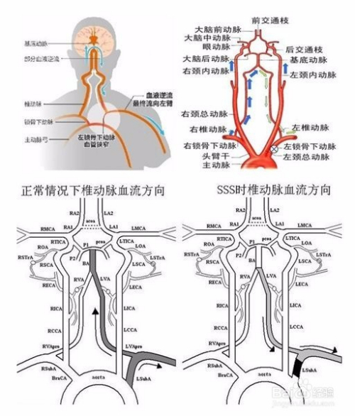 医学考试中颈部血管的检查