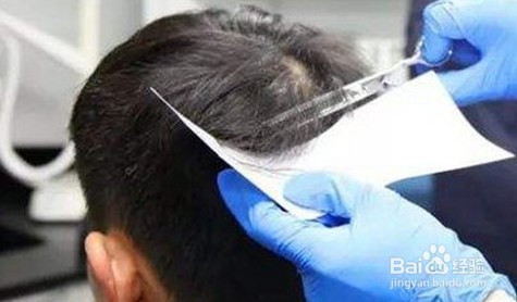 毛发毒品检测分析仪毛发取样流程