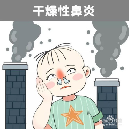 鼻炎类型有哪些