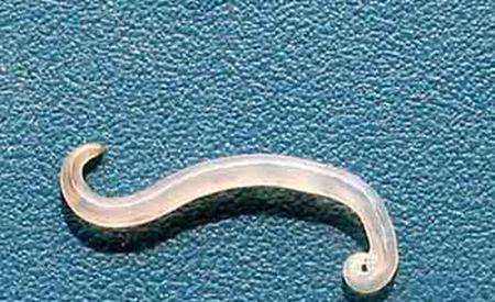 蛲虫图片，蛲虫图片及虫卵图片