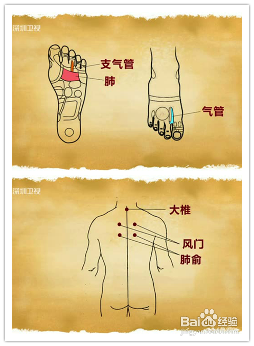 按摩治疗:可以点压,按揉足部的支气管,肺部,支气管反射区. 2.