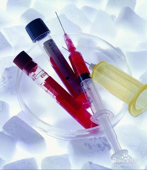 宠物医院做生化检验时,应该怎么制备血浆?