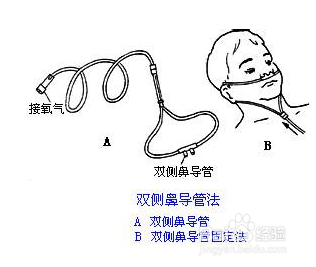 【制氧机】康居人家用制氧机操作方法