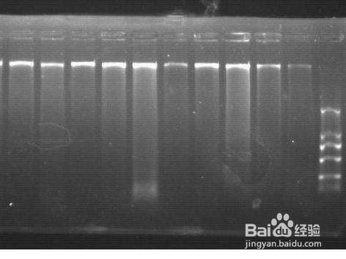 dna电泳条带怎么分析?