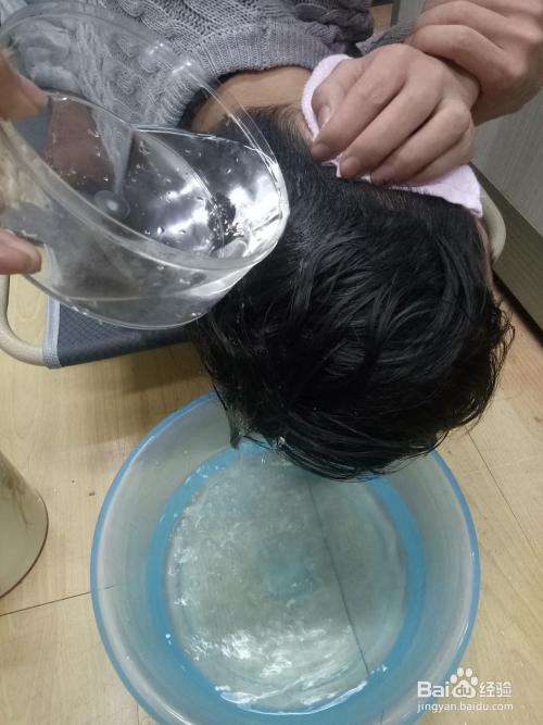 中耳炎患者手术后如何洗头发