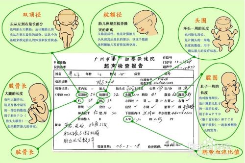 孕期b超四次为好:由于超声波是一种物理因素,一种能量,在胎儿组织器官