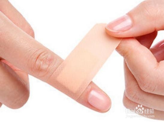 伤口有点化脓怎么办