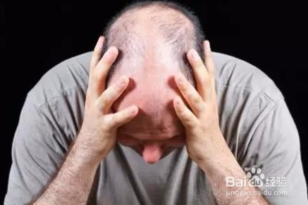 一直脱发怎么办