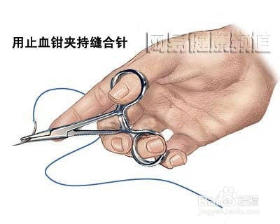 鱼儿难产剖腹手术