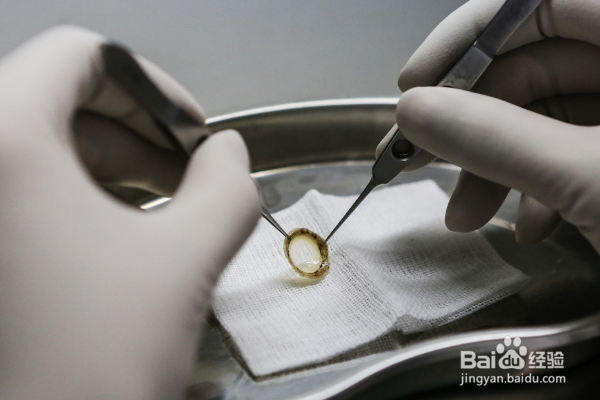 无菌技术有哪些注意事项？