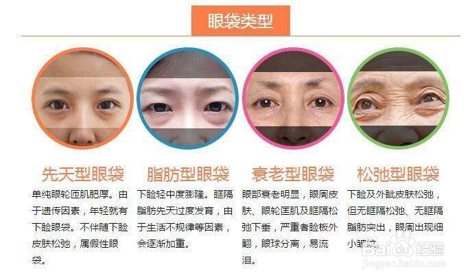 眼带用什么方法消除
