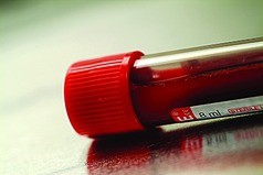 怎样办理健康证？