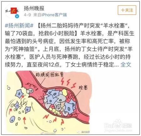 女明星自曝产后尿失禁!该如何应对产后尿失禁?