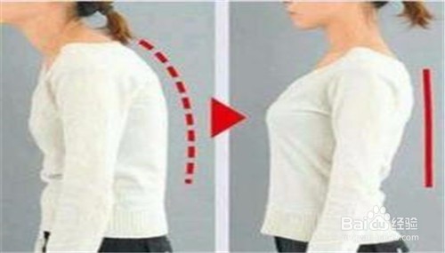 女生如何改掉驼背的坏毛病