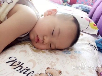 宝宝偏头丑掉渣,漂亮妈妈有妙方