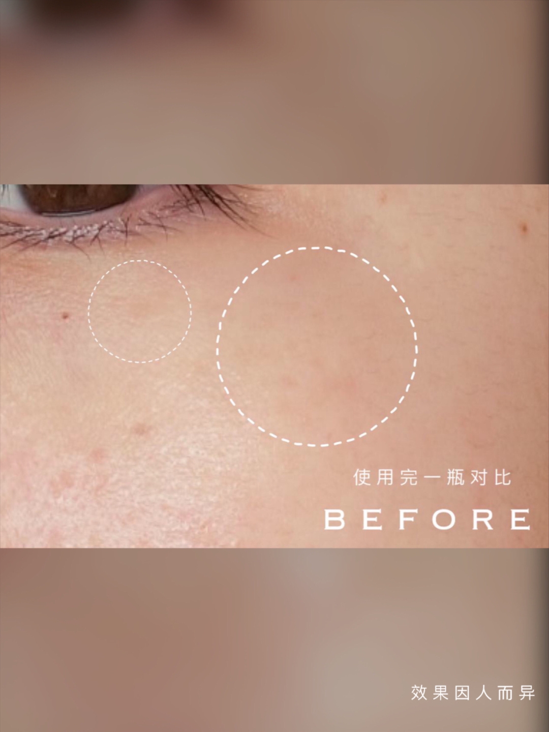 空瓶是真爱!科颜氏淡斑精华真正值得回购