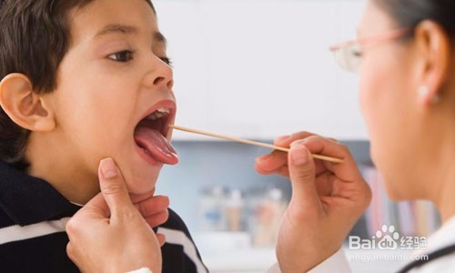 慢性咽炎症状表现哪些,用什么方法治疗