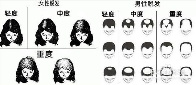 生活中简易护发，生发实用经验