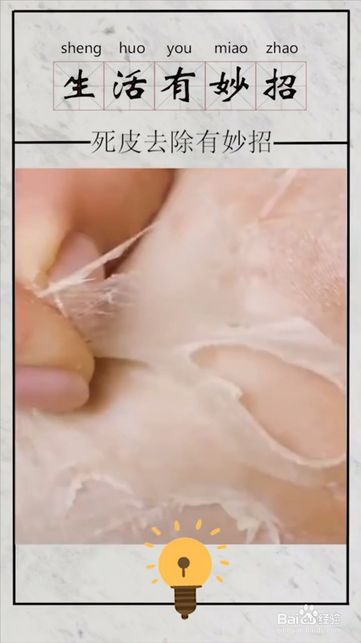 如何去除死皮？