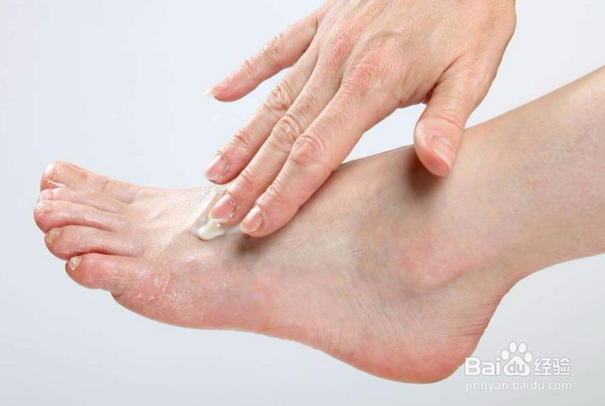 如何能够避免脚臭?