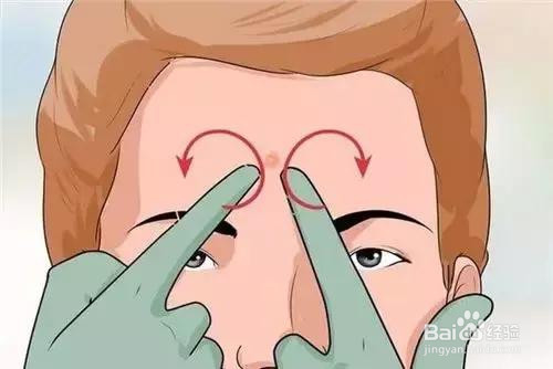 怎样控制皮肤长黑头