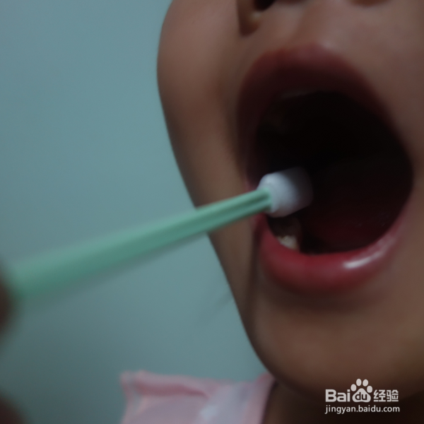 怎么进行DNA口腔黏膜脱落细胞采集