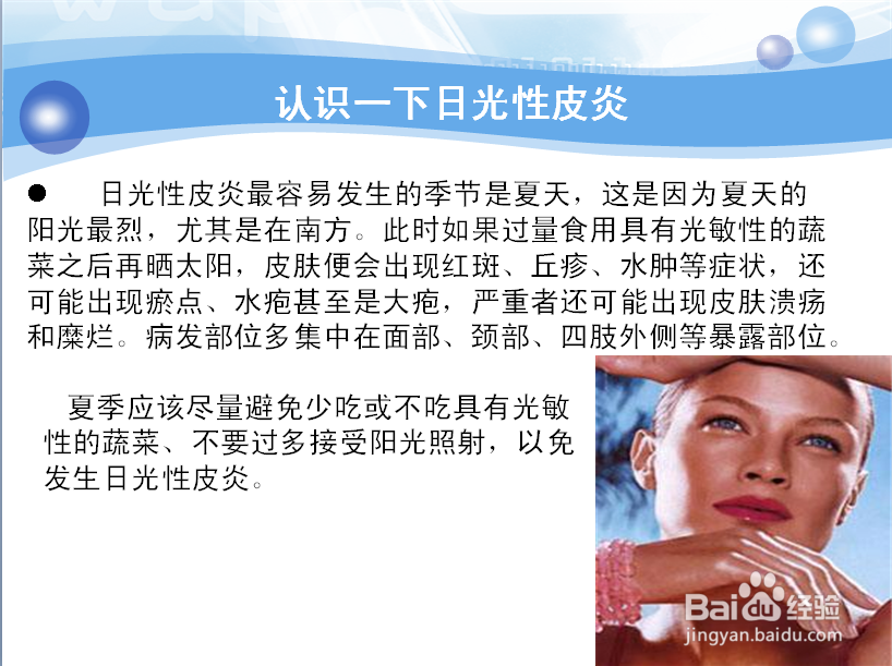 日光性皮炎能 治 好吗?