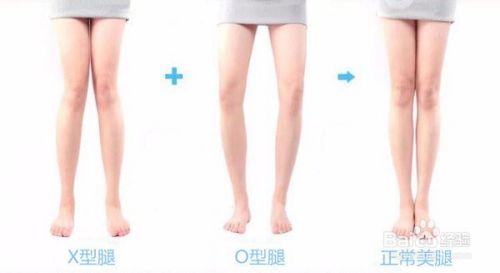各种不美观腿型如何瘦腿？