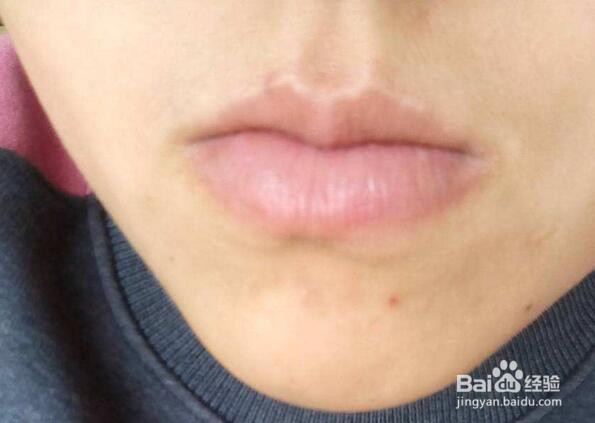擦口红嘴唇起皮怎么办