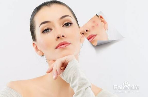 痘印多久能消除？祛痘印的方法有哪些？