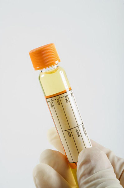 6种转瞬即逝身体生病前的征兆