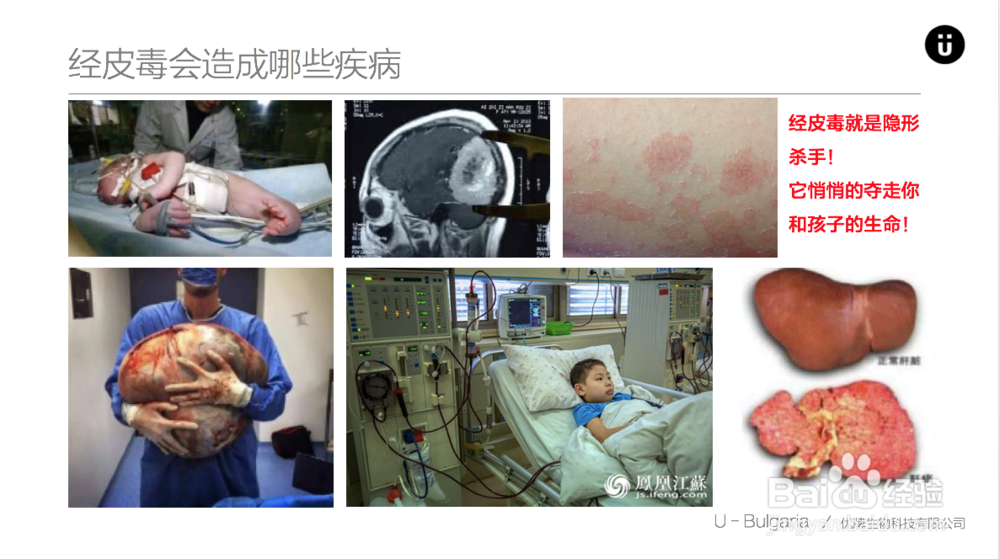 什么是经皮毒？