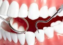 种植牙烤瓷牙的区别