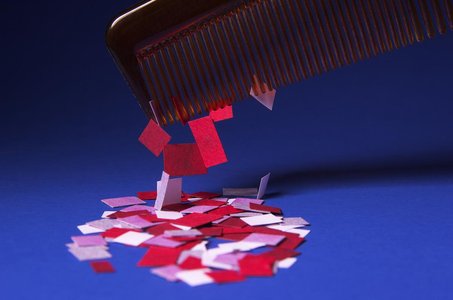 天冷了，裤子上带静电，老是贴在腿上，请问怎么解决