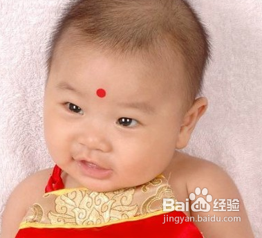 婴儿长湿疹怎么办