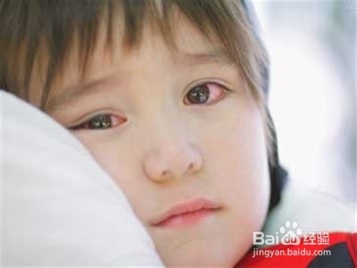 哪些人不能做双眼皮手术