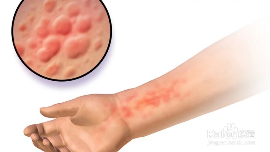 酒精喷手消毒,这三点要注意