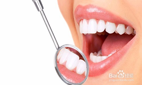 贴面美白牙齿