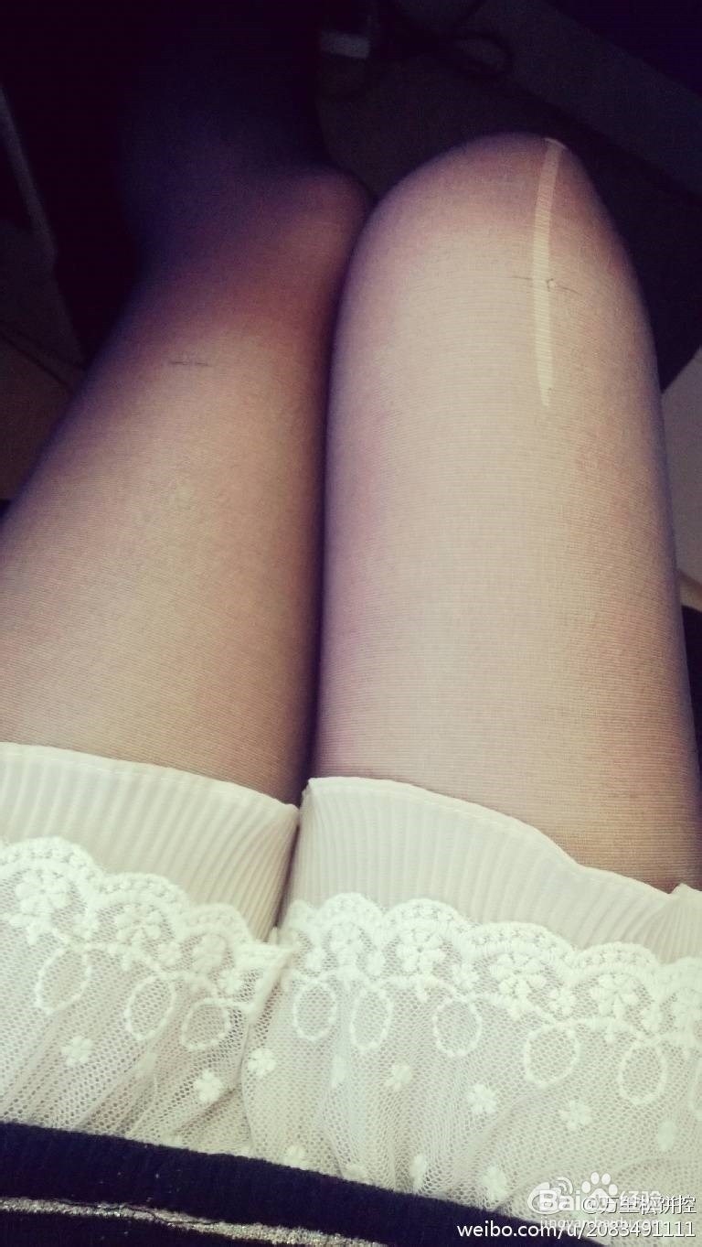 丝袜勾丝了怎么办