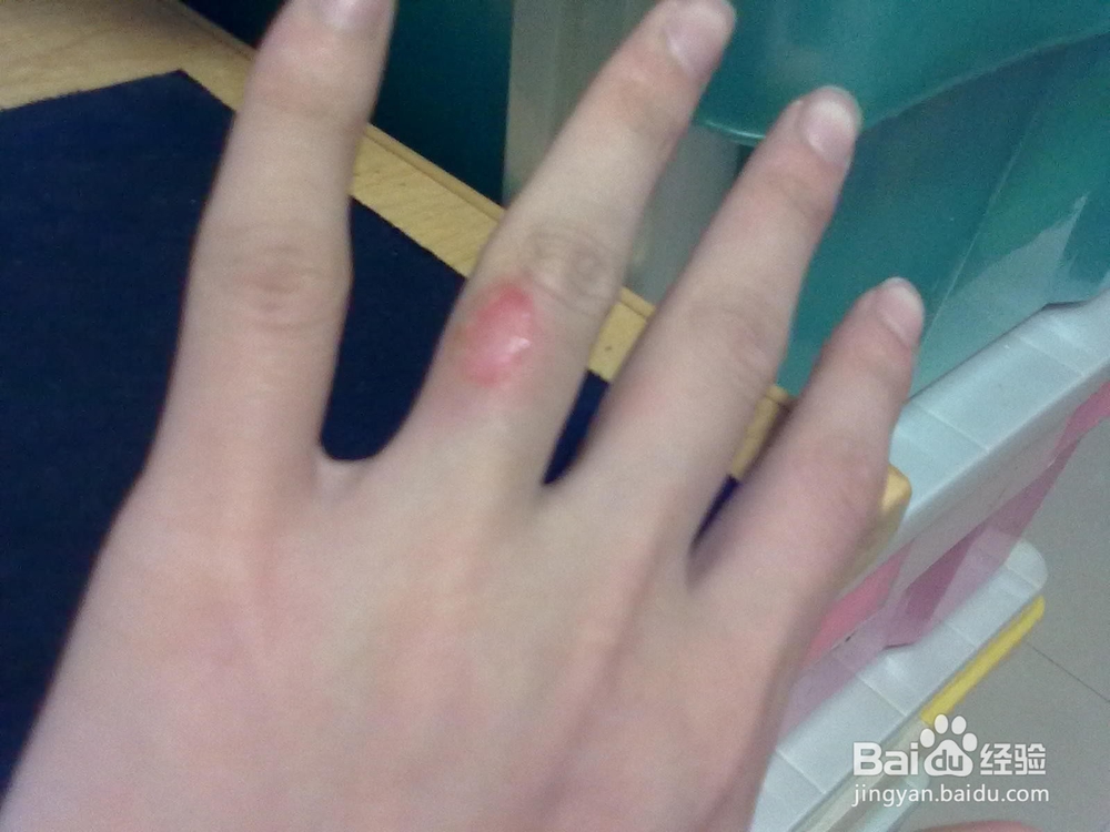 巧用食盐解决身体小麻烦