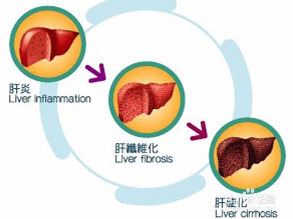 睡眠对于健康的重要性!