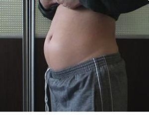 怎样判断你的体内是否有湿气